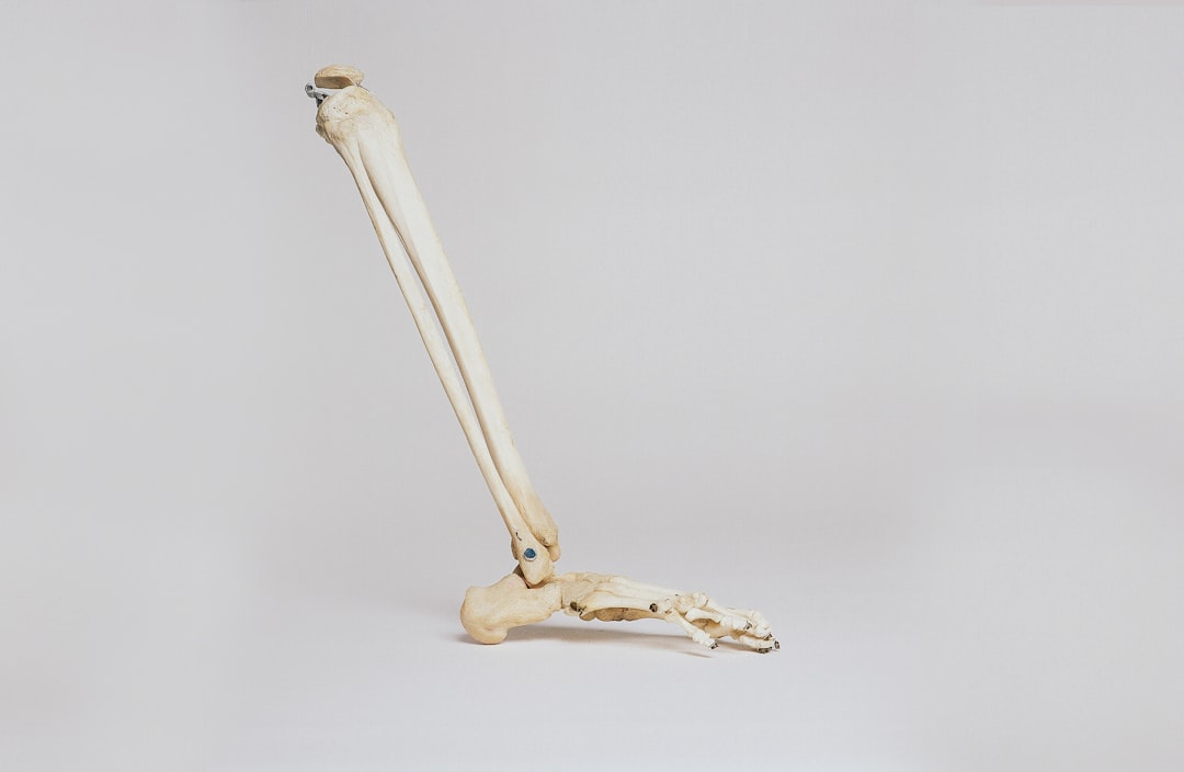 Tibia and Fibula Bone